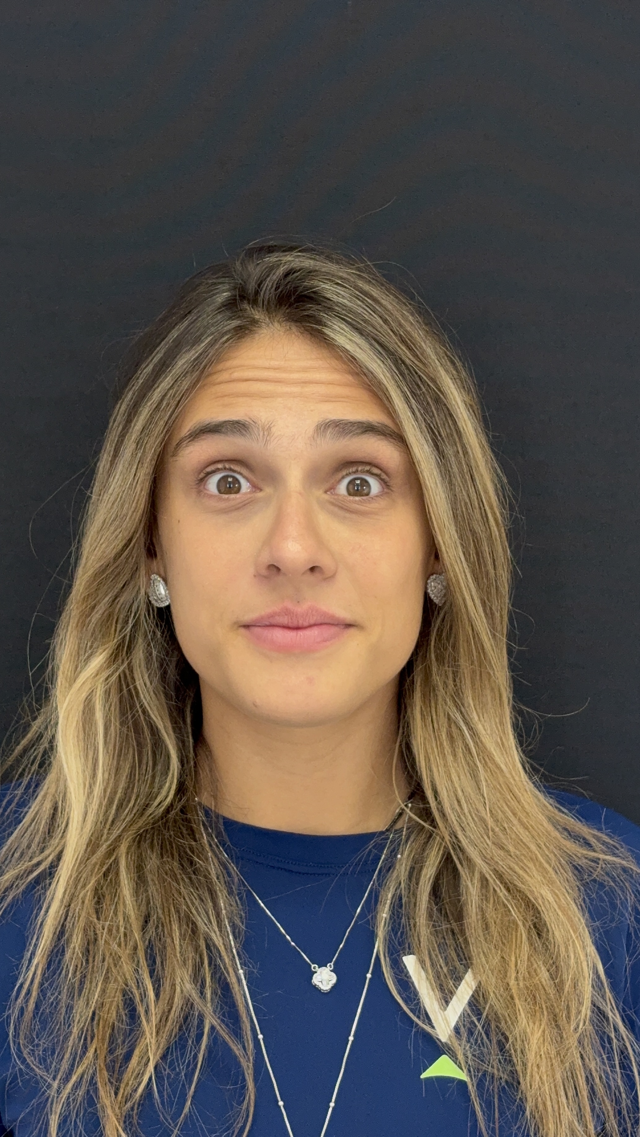 Antes